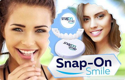 Snap-On Smile